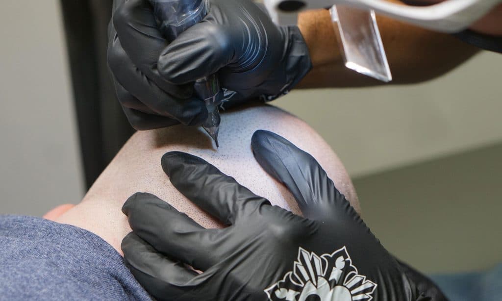 Scalp Micropigmentation Cost | Natural Scalp Cardiff